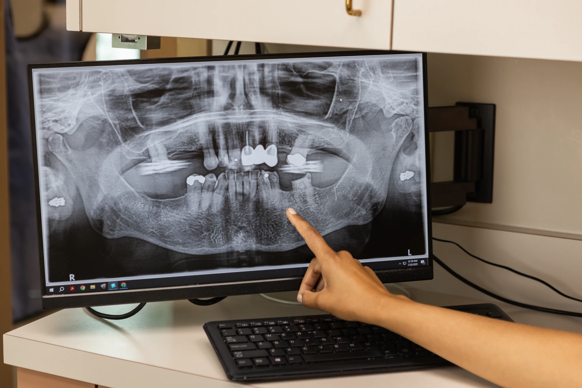 Dr. Priya Sridhar reviewing a digital dental X-ray to diagnose a dental emergency